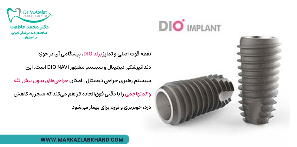 ایمپلنت کره ای برند DIO
