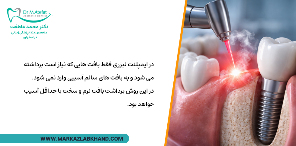 ایمپلنت دندان با لیزر چیست؟