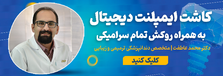 کاشت ایمپلنت دیجیتال در اصفهان نوبت دهی