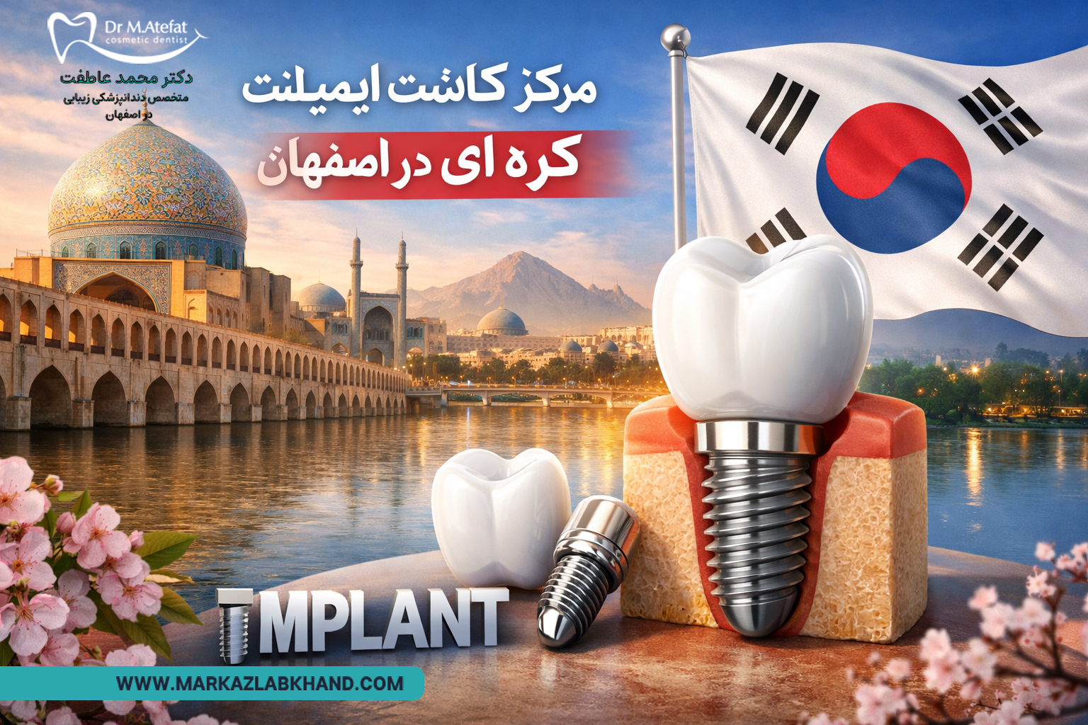 مرکز کاشت ایمپلنت کره ای در اصفهان