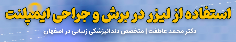 تماس با ما در ایمپلنت دیجیتال در اصفهان 