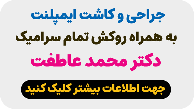 نوبت دهی کاشت ایمپلنت در اصفهان