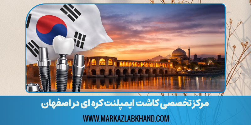 مرکز کاشت ایمپلنت کره ای در اصفهان