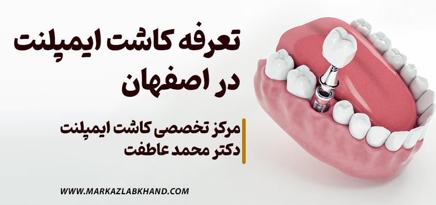 تعرفه ی ایمپلنت در اصفهان در مرکز ایمپلنت دکتر محمد عاطفت