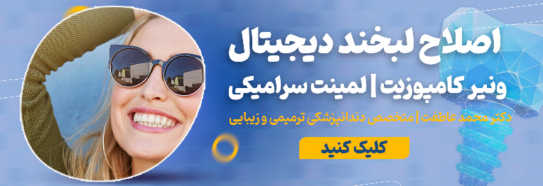 اصلاح لبخند دیجیتال در اصفهان دکتر محمد عاطفت