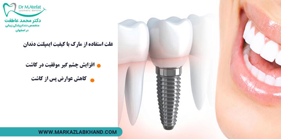 علت استفاده از بهترین مارک های ایمپلنت دندان در اصفهان