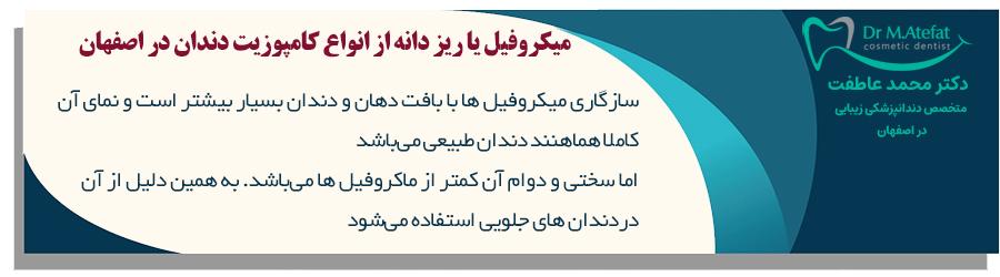 میکروفیل از انواع کامپوزیت دندان در اصفهان