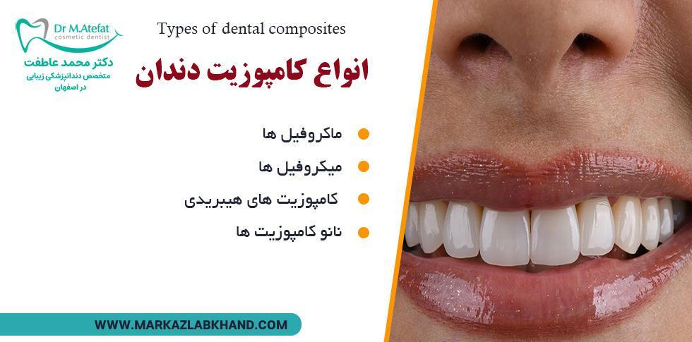 انواع کامپوزیت دندان در اصفهان توسط دکتر محمد عاطفت