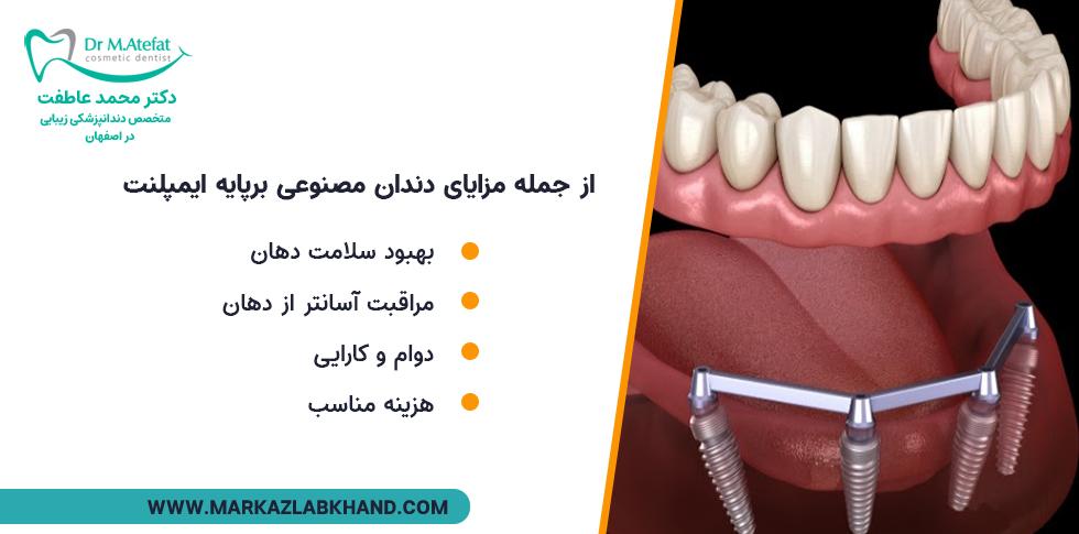 مزایای دندان مصنوعی بر پایه ایمپلنت