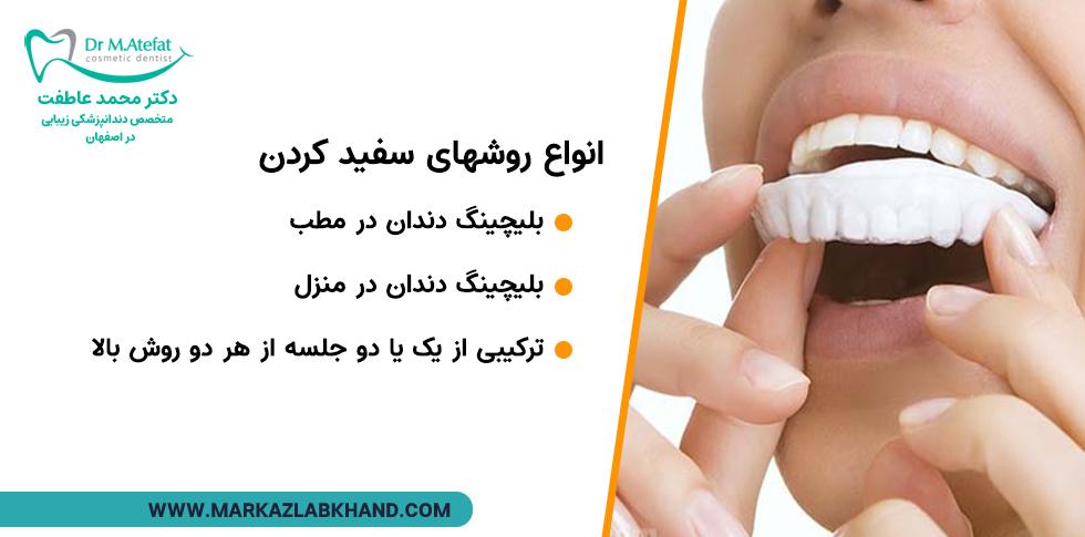 انواع روش های سفید کردن دندان در اصفهان