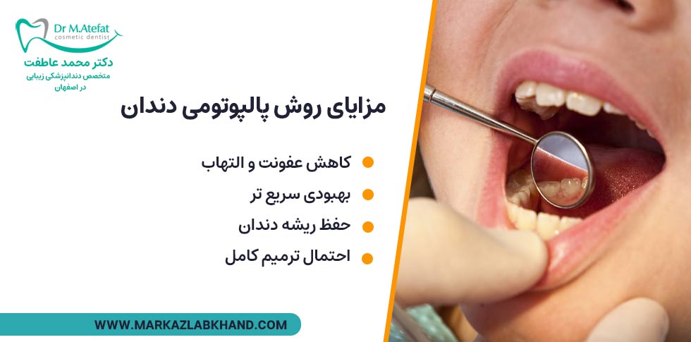 مزایای پالپوتومی دندان
