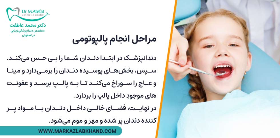 مراحل انجام پالپوتومی دندان شیری کودکان