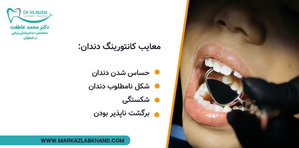 معایب کانتورینگ دندان