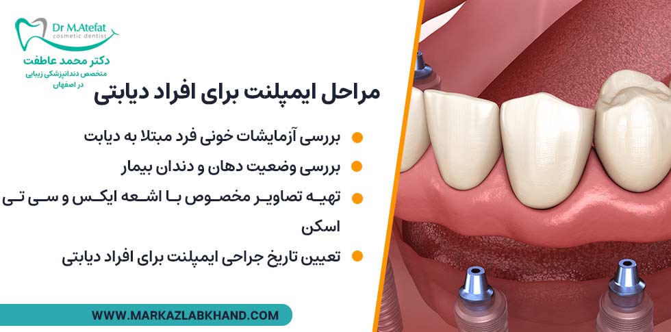 مراحل ایمپلنت برای افراد دیابتی