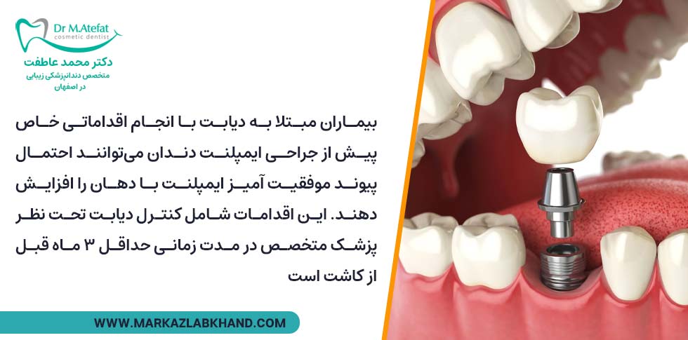 ایمپلنت کردن دندان افراد دیابتی