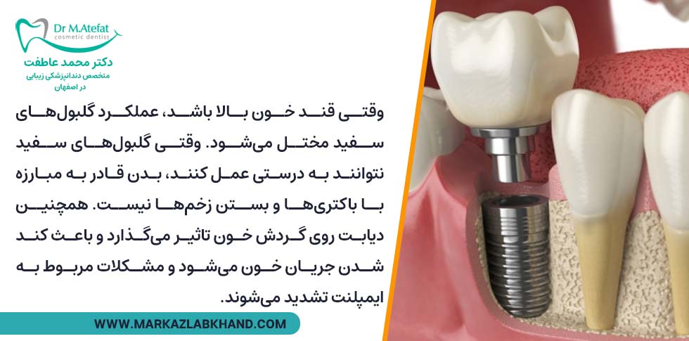 کاهش احتمال موفقیت آمیز بودن کاشت ایمپلنت