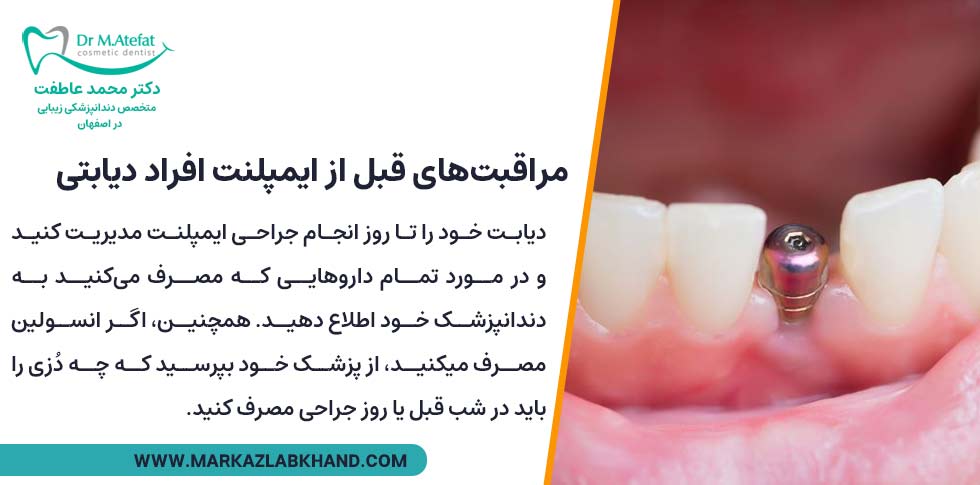 مراقبت‌های قبل از کاشت دندان برای افراد دیابتی