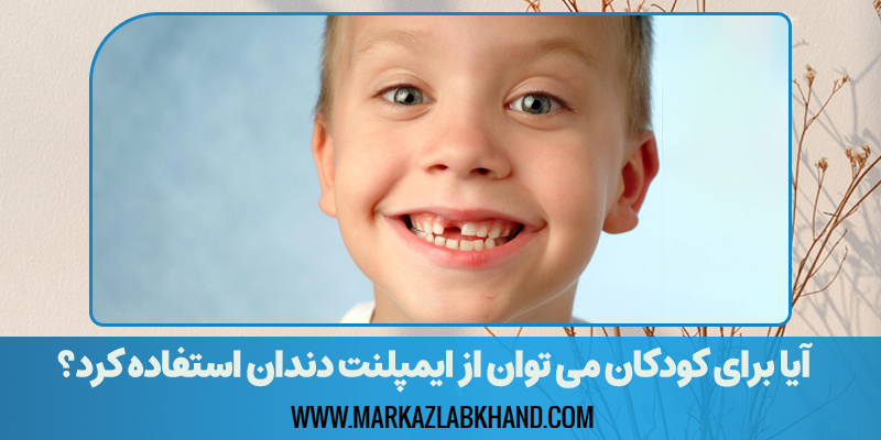 آیا برای دندان های از دست رفته کودکان می توان از ایمپلنت دندان استفاده کرد؟