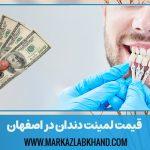 قیمت لمينت دندان در اصفهان