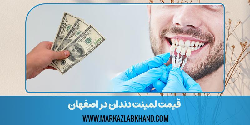 قیمت لمينت دندان در اصفهان