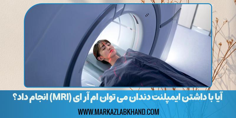 آیا با داشتن ایمپلنت دندان می توان ام آر ای (MRI) انجام داد؟