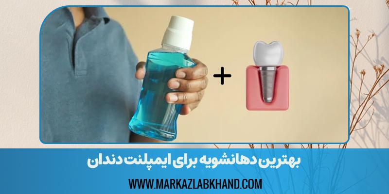 بهترین دهانشویه برای ایمپلنت دندان