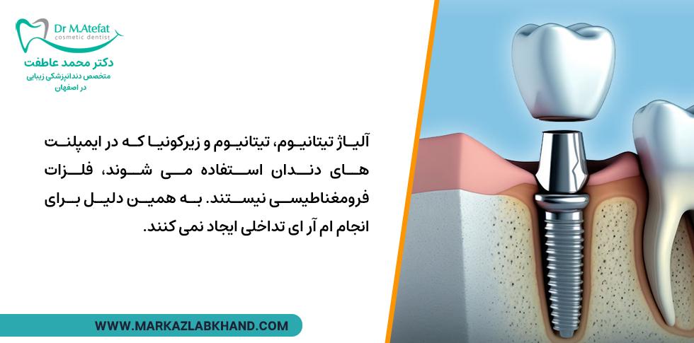 ایمپلنت های تیاتنیومی برای انجام ام آر آی مشکلی ندارند