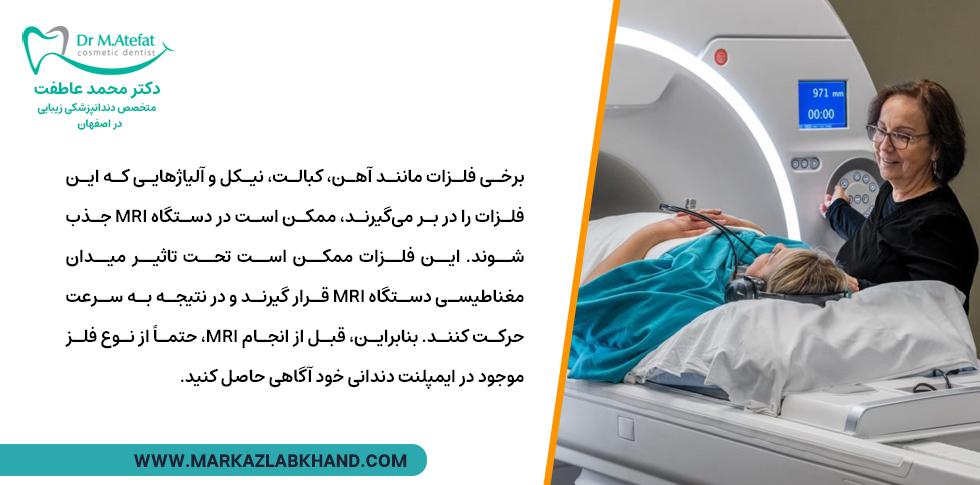 نوع آلیاژ ایمپلنت دندان و ام آرآی