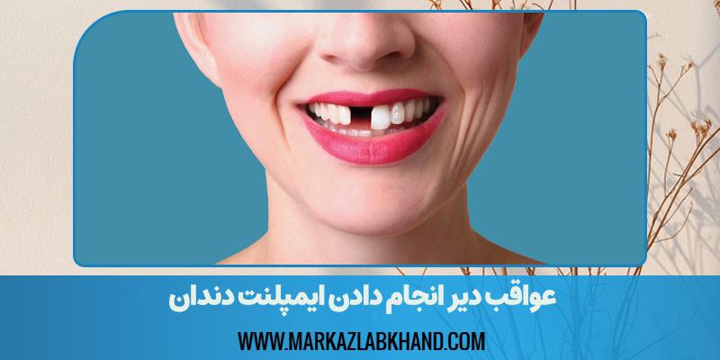 عواقب دیر انجام دادن ایمپلنت دندان