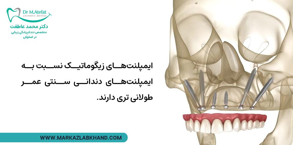 طول عمر ایمپلنت زیگوماتیک