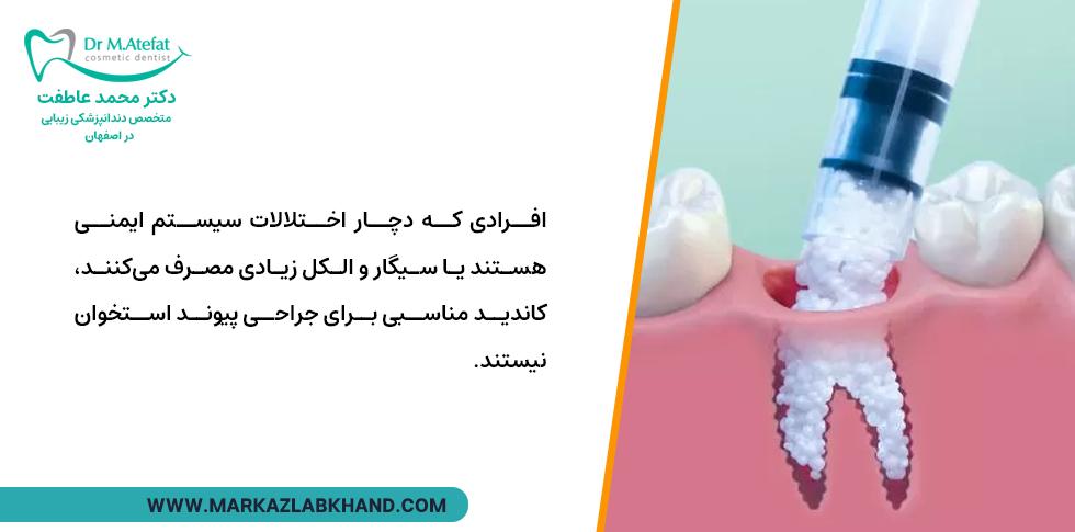 افراد سیگاری نباید پویند استخوان برای ایمپلنت انجام دهند