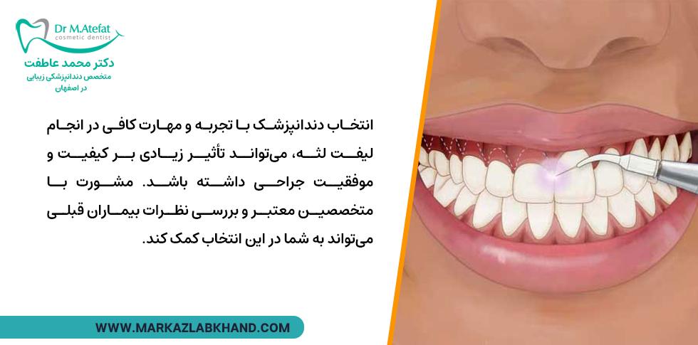 انتخاب دندانپزشک با تجربه برای لیفت لثه