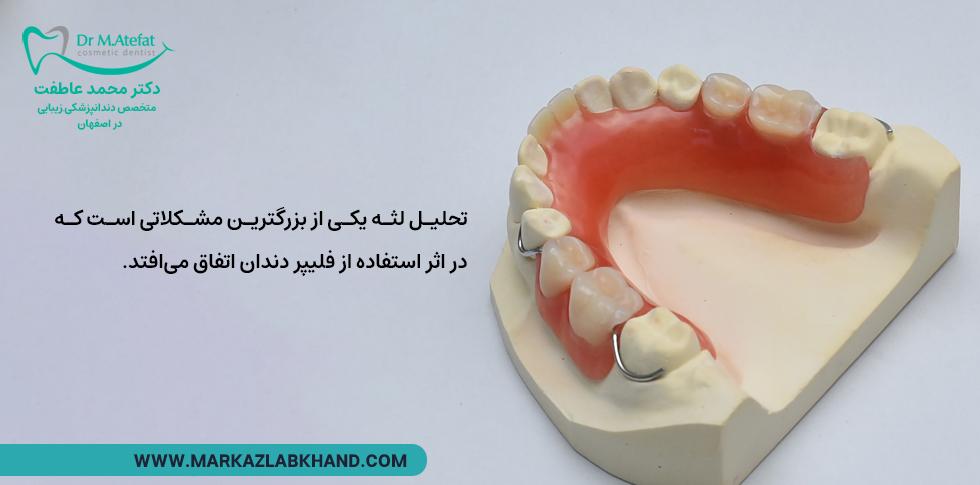 تحلیل لثه با فیلیپر دندان