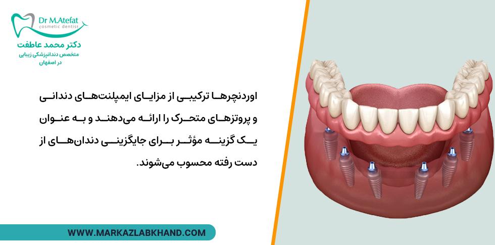 ارودنچر برای پر کردن جای خالی دندان ها