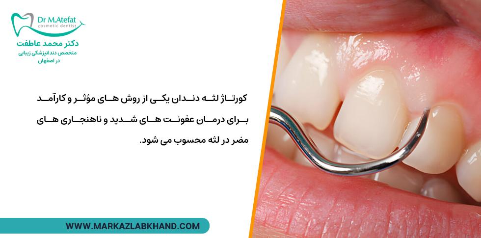 کورتاژ لثه چیست؟