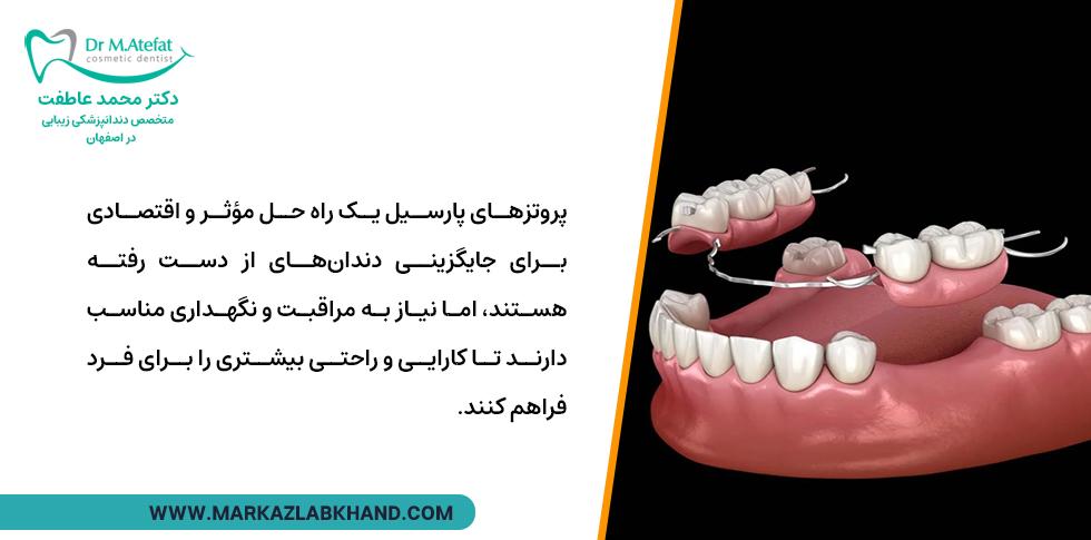 پروتزهای پارسیل برای پر کردن جای خالی دندان ها