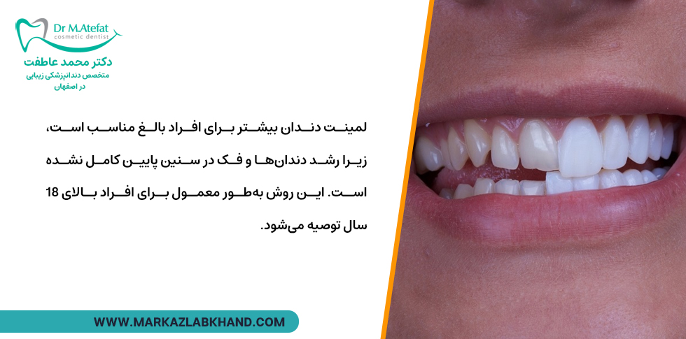 محدودیتهای سنی برای لمینت دندان