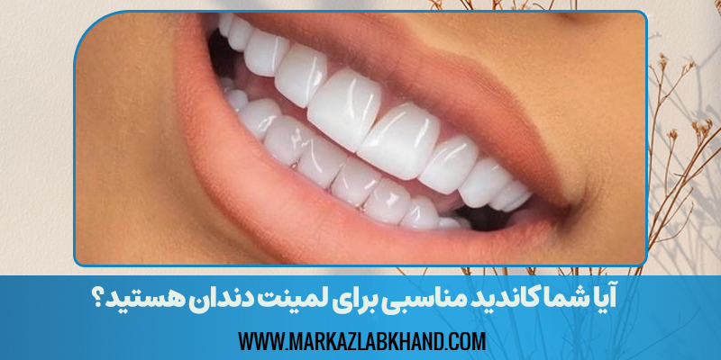 آیا شما کاندید مناسبی برای لمینت دندان هستید؟