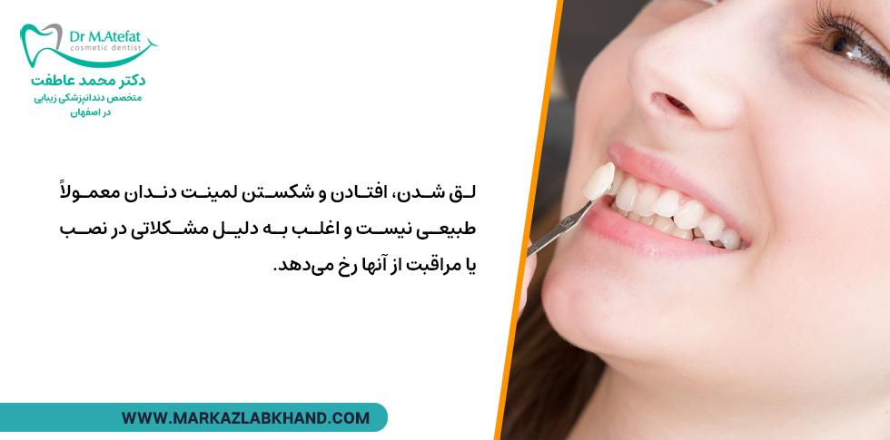 افتادن لمینت دندان طبیعی نیست