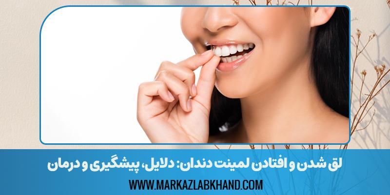 افتادن لمینت دندان
