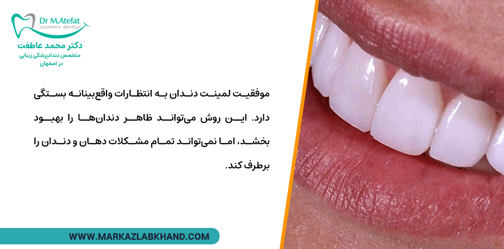 انتظار واقع بینانه از لمینت دندان