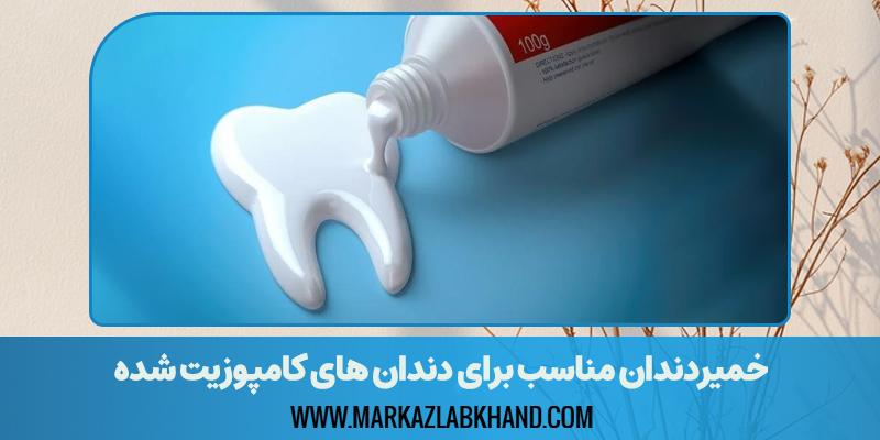 خمیردندان مناسب برای دندان های کامپوزیت شده