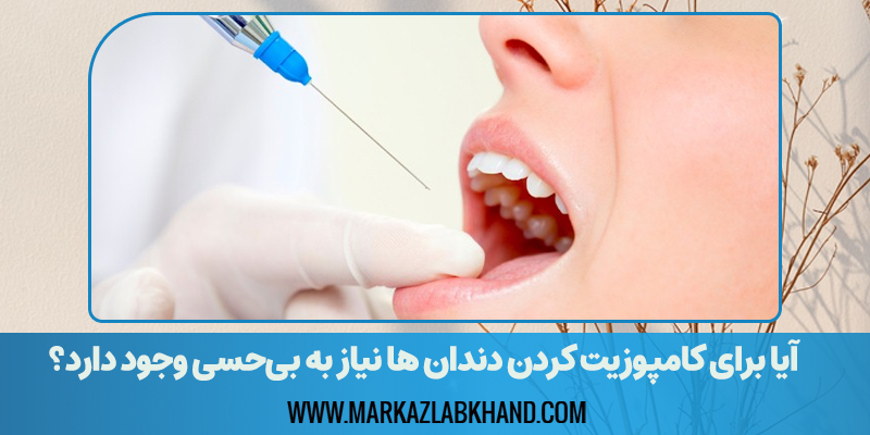 آیا برای کامپوزیت کردن دندان ها نیاز به بی‌حسی وجود دارد؟