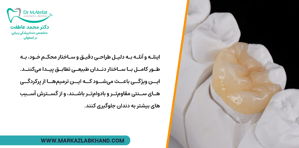 مزایای اینله و آنله دندان