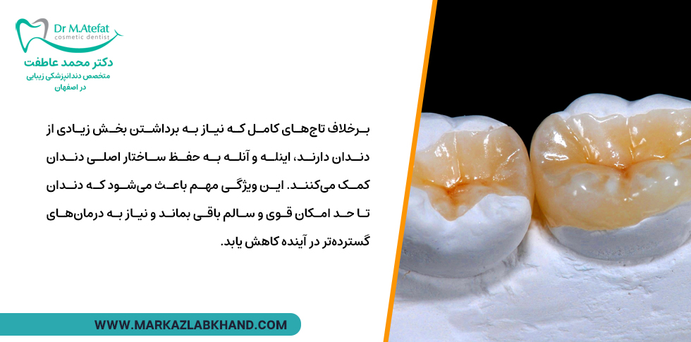مقاومت اینله و آنله دندان