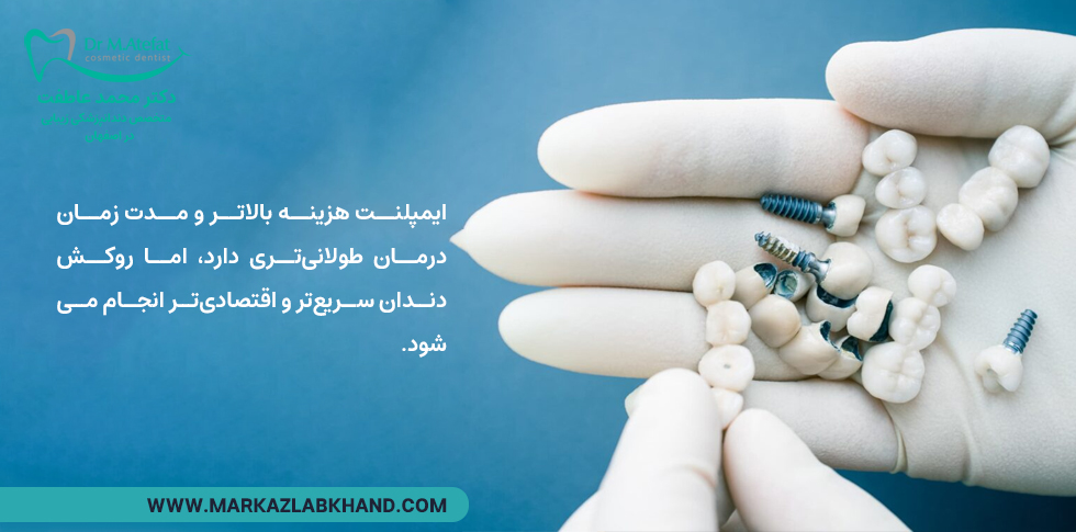 تفاوت روکش و ایمپلنت دندان درهزینه و مدت زمان درمان