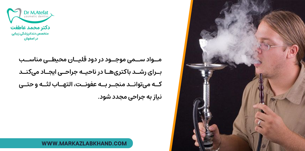 عوارض مصرف قلیان بعد از کاشت ایمپلنت دندان