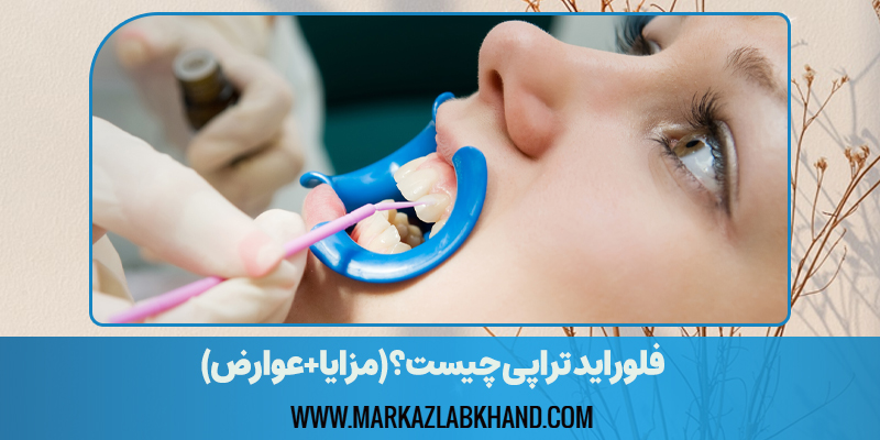 فلوراید تراپی چیست؟(مزایا+عوارض)