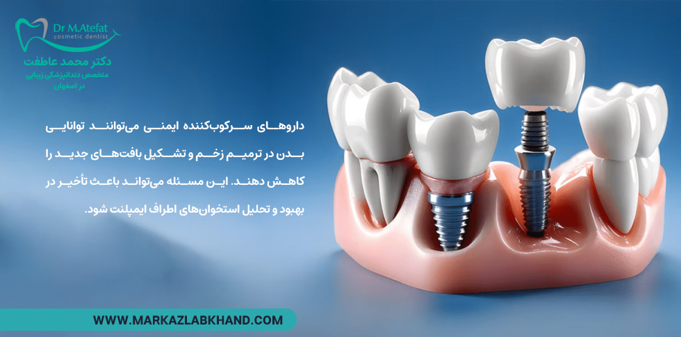 بیماری های خودایمنی و ایمپلنت دندن