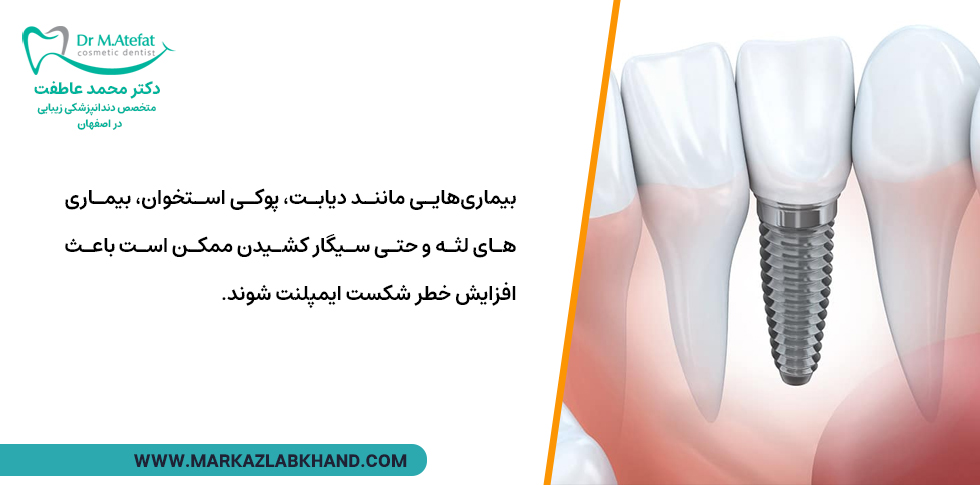 بیماری هایی که بر روی ایمپلنت دندان تاثیر می گذارند
